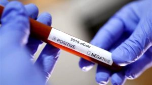 Hollanda’da son 24 saatte koronavirüsten 83 ölüm