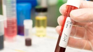 Bilim insanları Hollanda’da HIV virüsünün daha zararlı ve bulaşıcı varyantını buldu