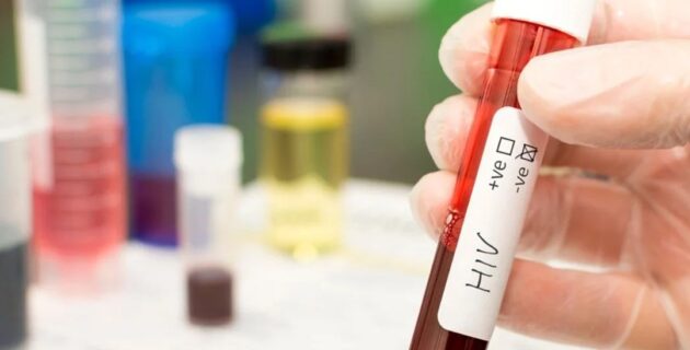 Bilim insanları Hollanda’da HIV virüsünün daha zararlı ve bulaşıcı varyantını buldu